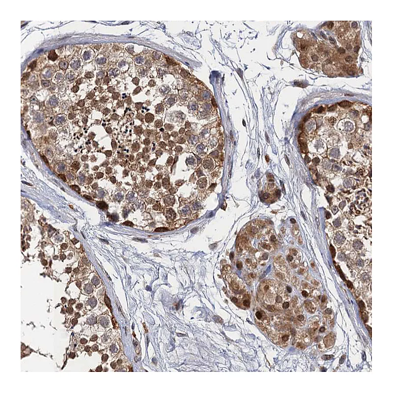 Atlas Antibodies Anti-NEK8 Antibody