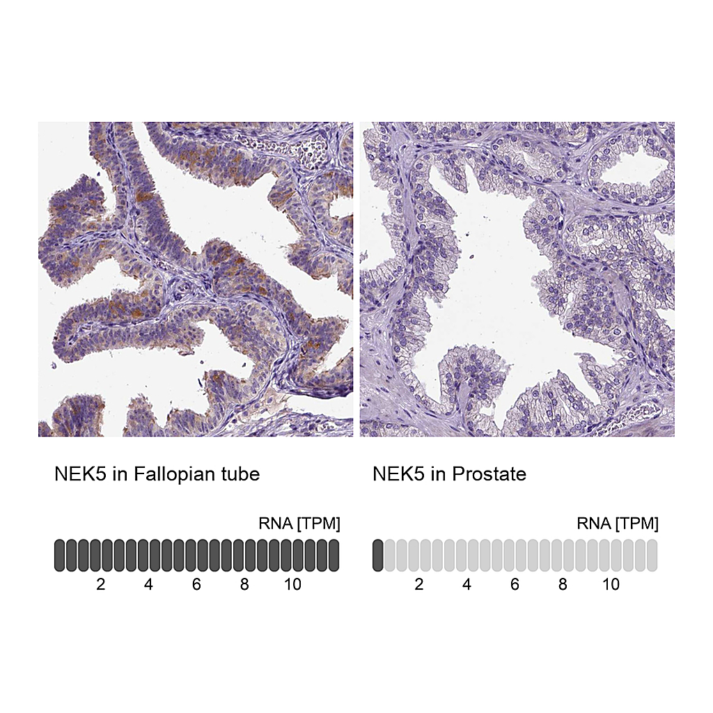 Atlas Antibodies Anti-NEK5 Antibody