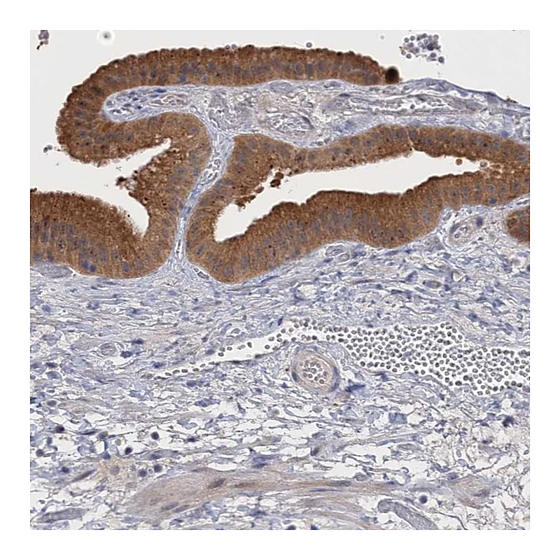 Atlas Antibodies Anti-NEK8 Antibody