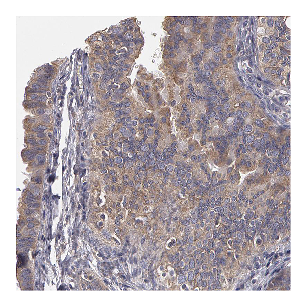 Atlas Antibodies Anti-NEK9 Antibody