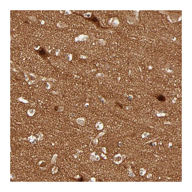 Atlas Antibodies Anti-NEMF Antibody