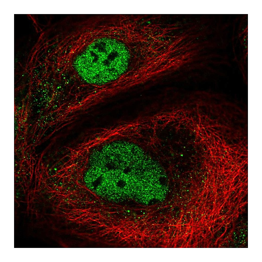 Atlas Antibodies Anti-NEMP2 Antibody