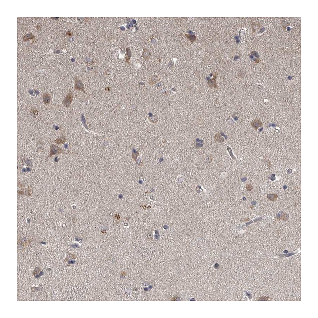 Atlas Antibodies Anti-NENF Antibody