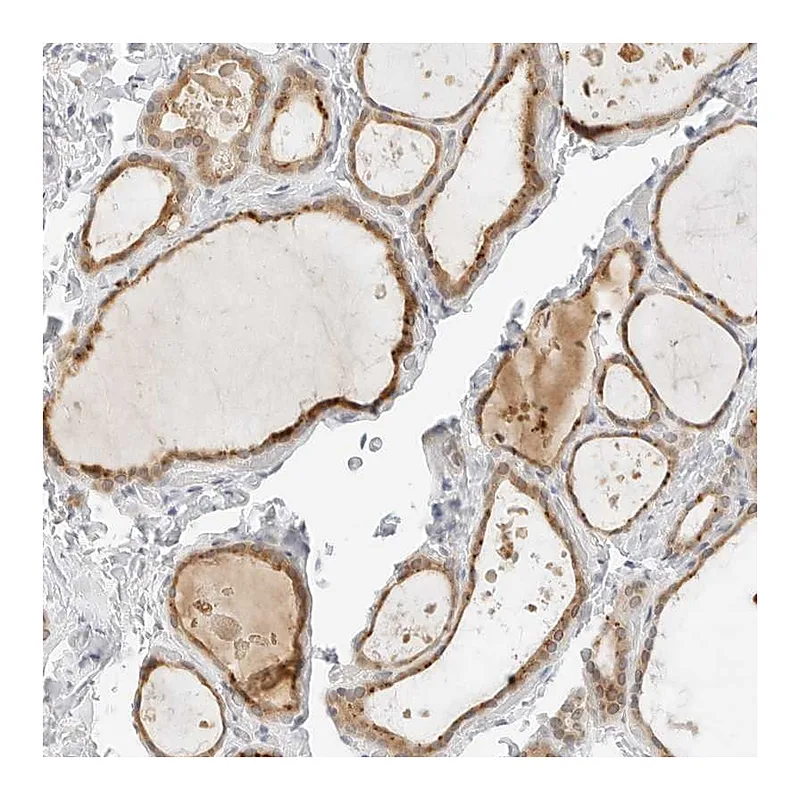 Atlas Antibodies Anti-NEO1 Antibody