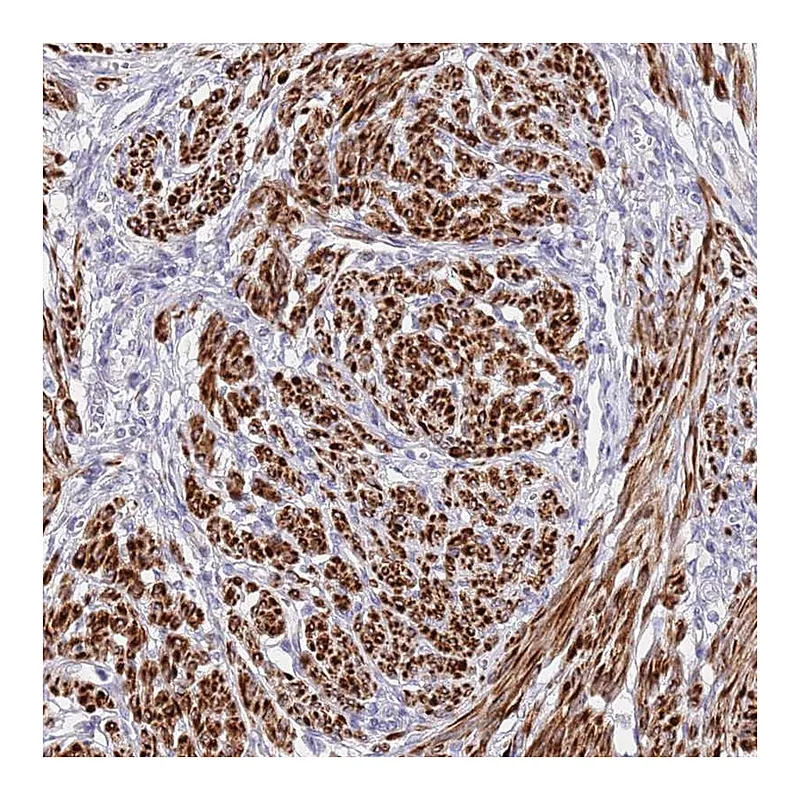 Atlas Antibodies Anti-NET1 Antibody
