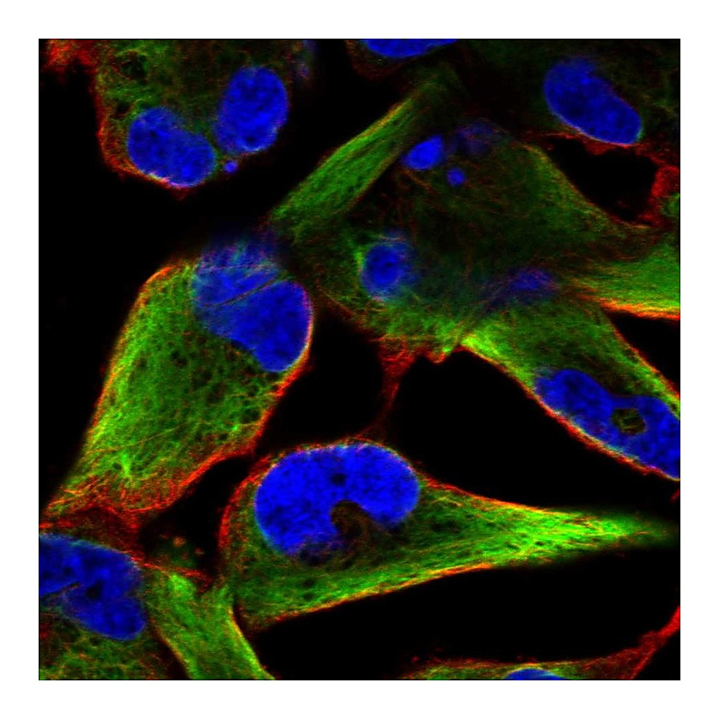 Atlas Antibodies Anti-NES Antibody