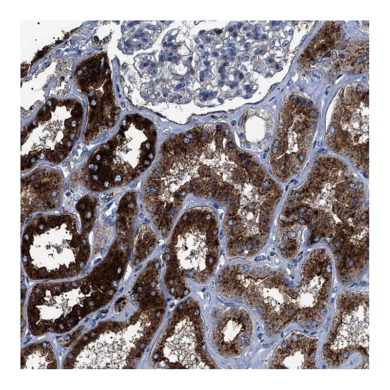 Atlas Antibodies Anti-NEU1 Antibody