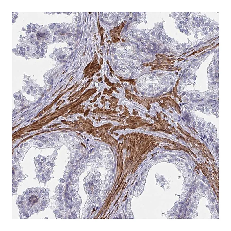 Atlas Antibodies Anti-NEURL4 Antibody