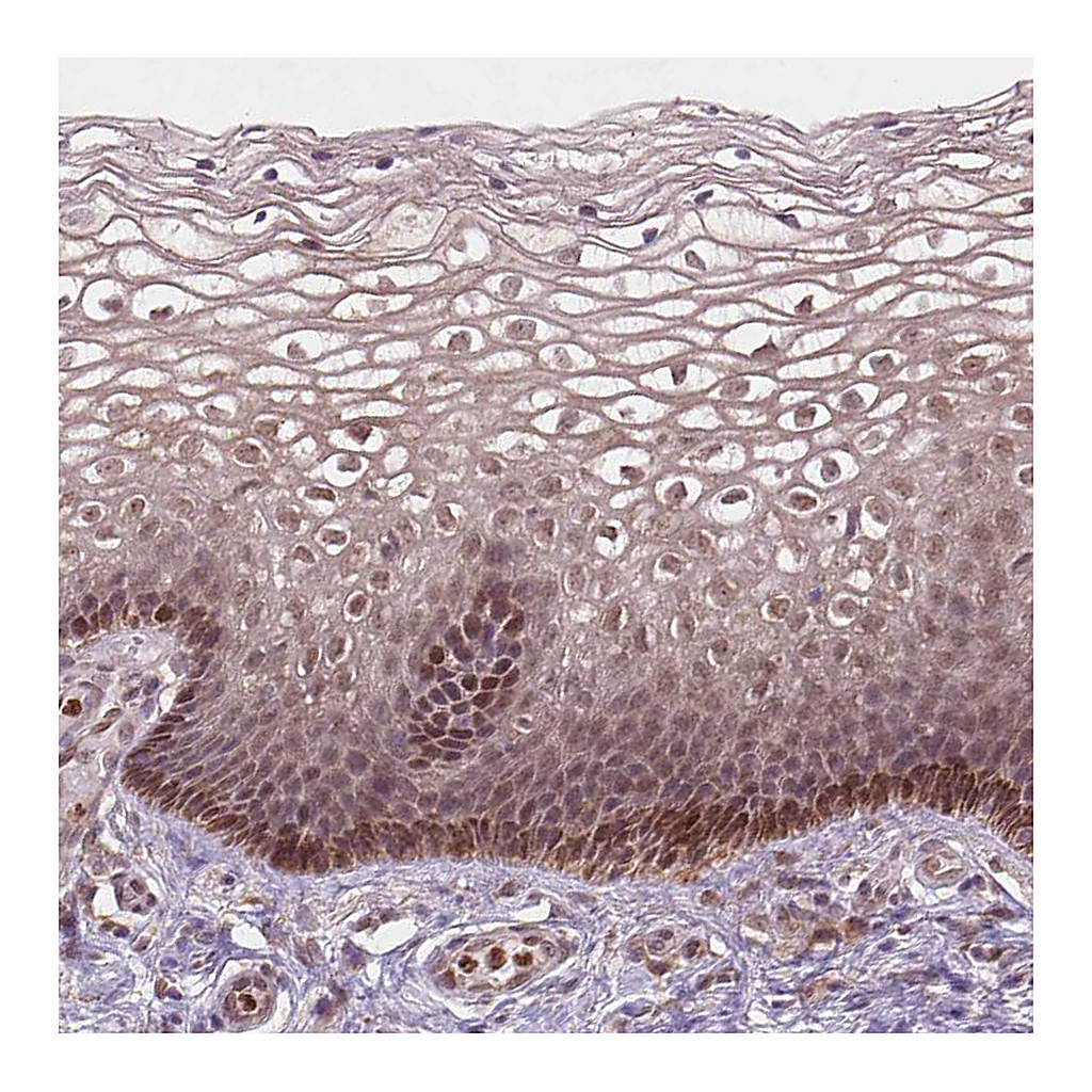 Atlas Antibodies Anti-NFAT5 Antibody