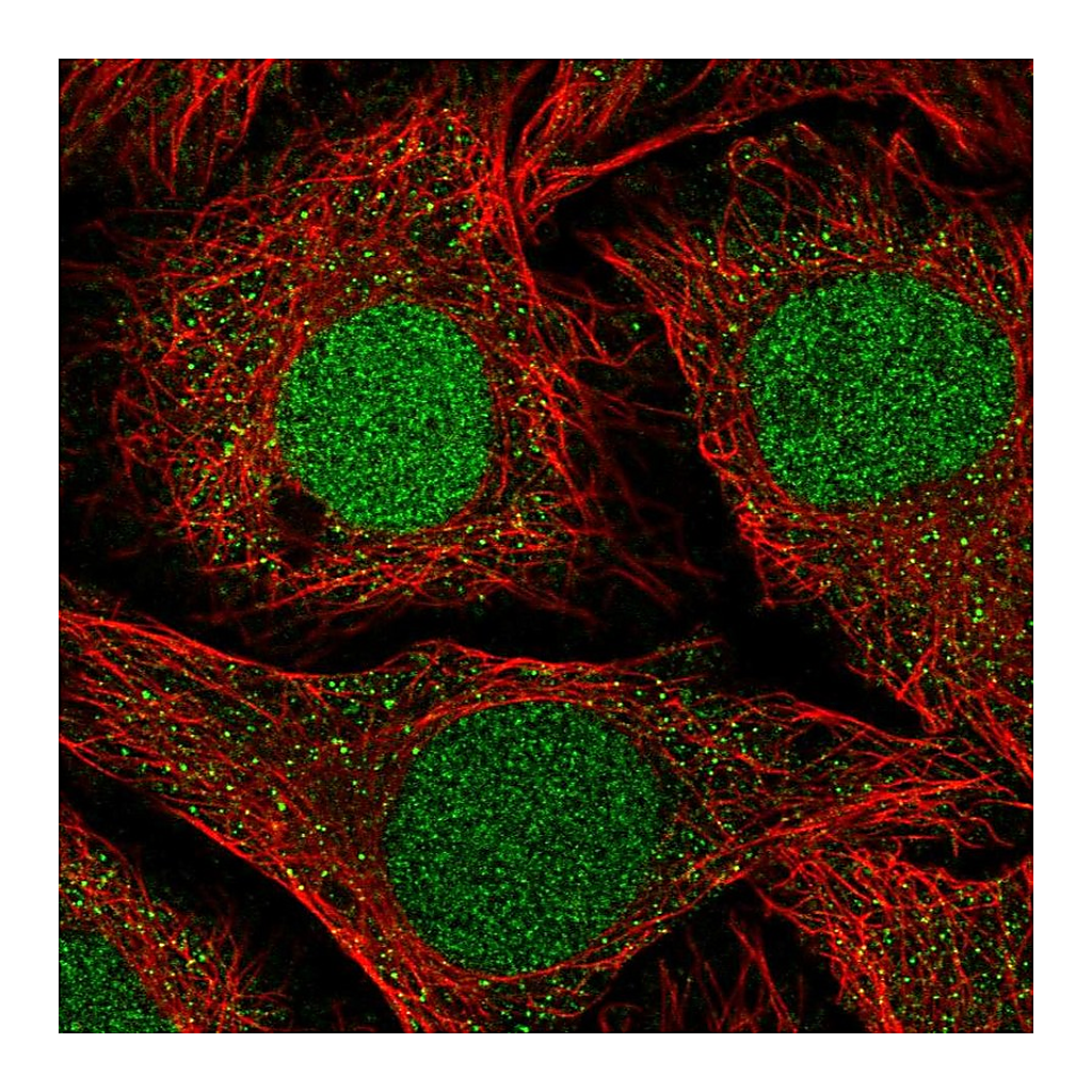 Atlas Antibodies Anti-NFATC2IP Antibody