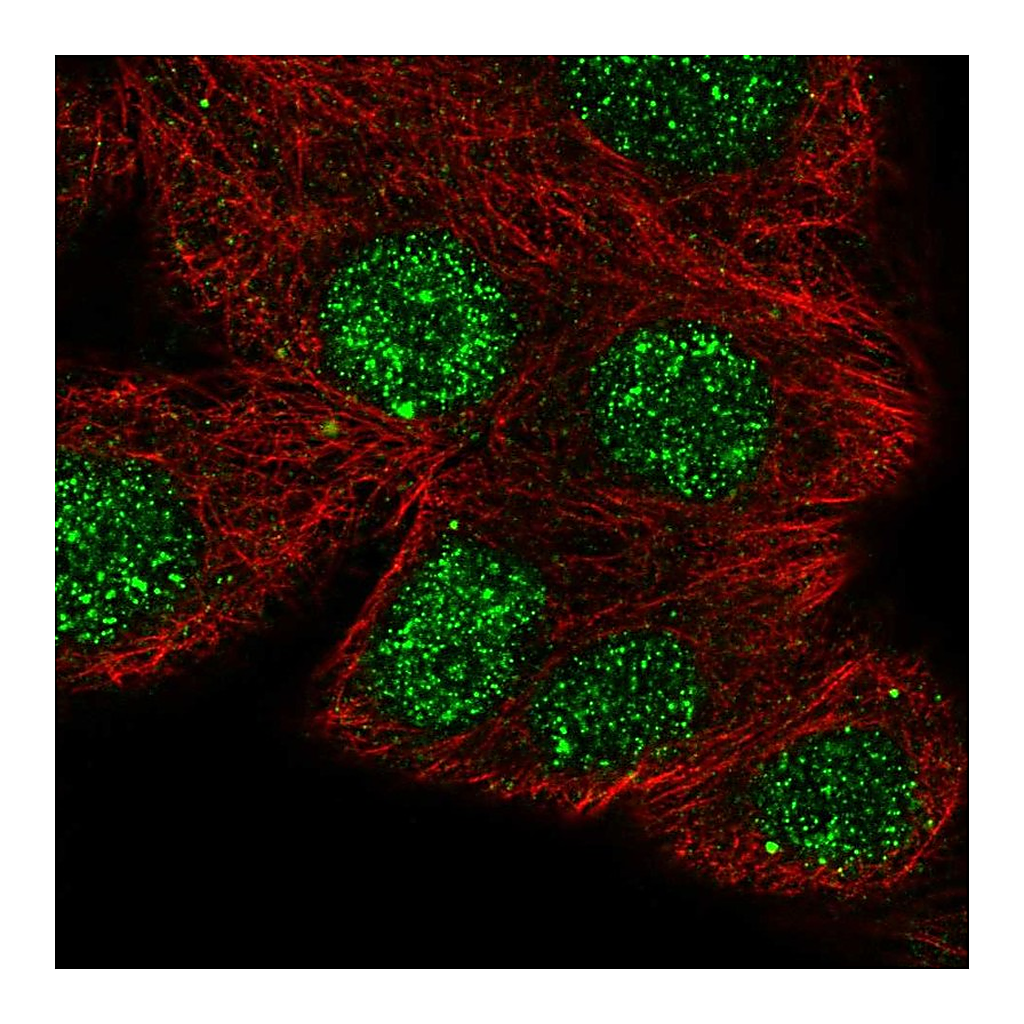 Atlas Antibodies Anti-NFATC1 Antibody