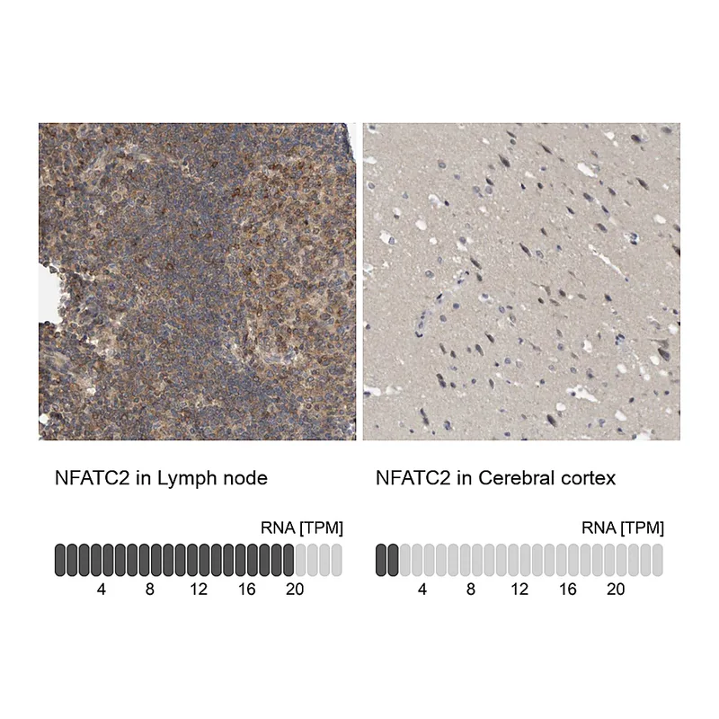 Atlas Antibodies Anti-NFATC2 Antibody
