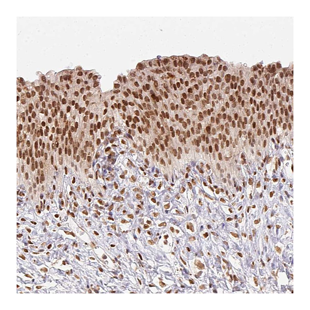 Atlas Antibodies Anti-NFE2L1 Antibody