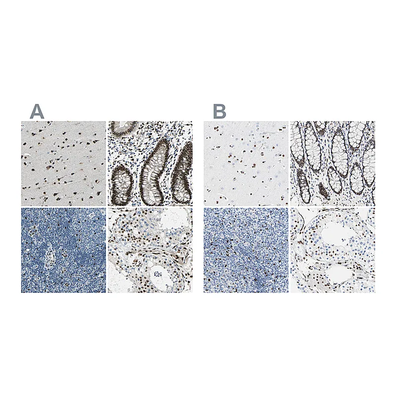 Atlas Antibodies Anti-NFIA Antibody