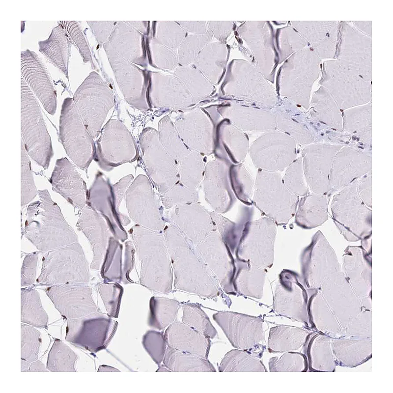 Atlas Antibodies Anti-NFIC Antibody