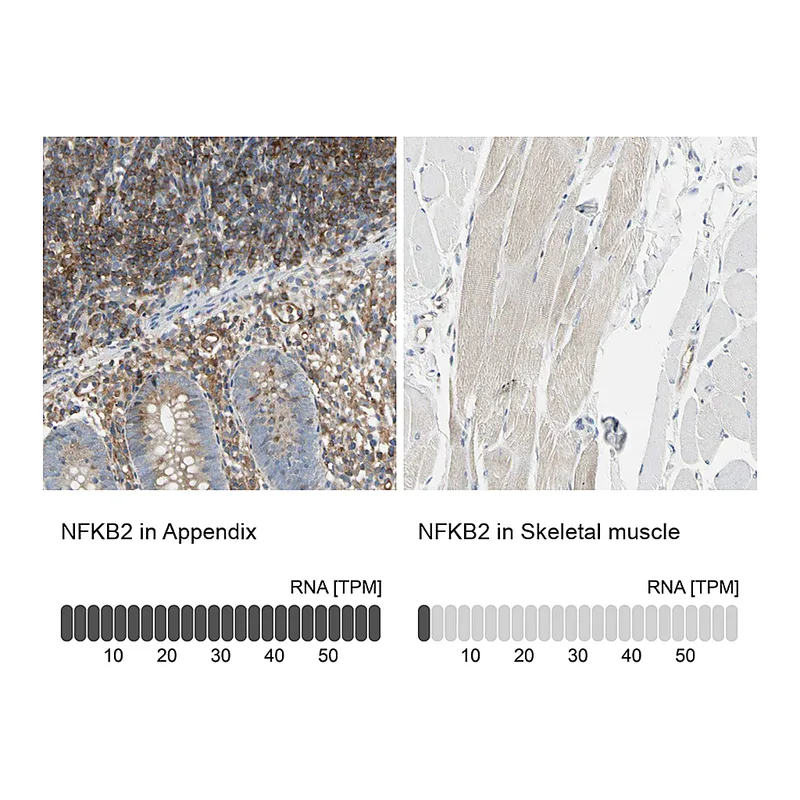Atlas Antibodies Anti-NFKB2 Antibody