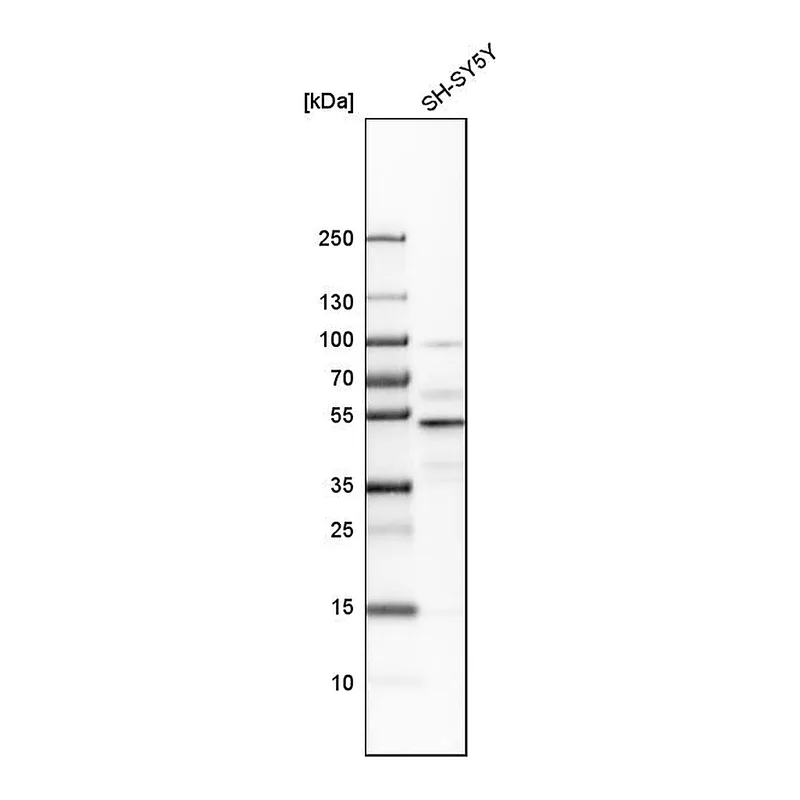 Atlas Antibodies Anti-NFIB Antibody