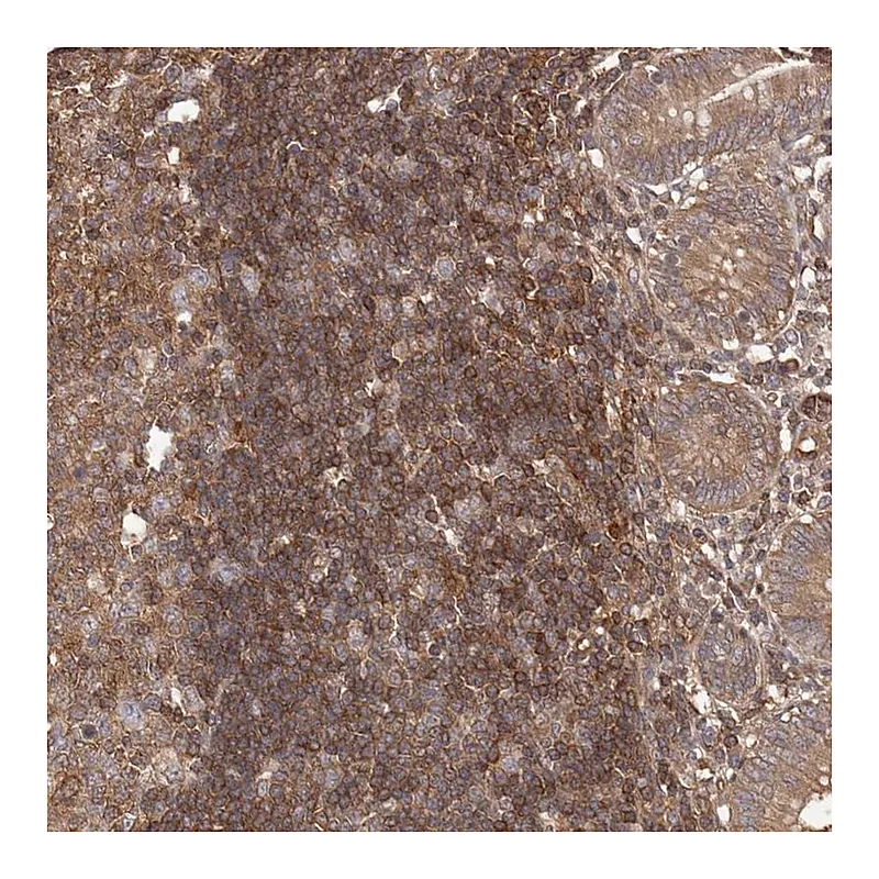 Atlas Antibodies Anti-NFKBIA Antibody