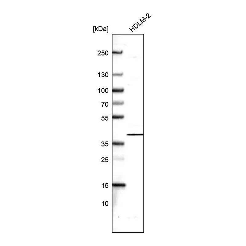 Atlas Antibodies Anti-NFKBIB Antibody