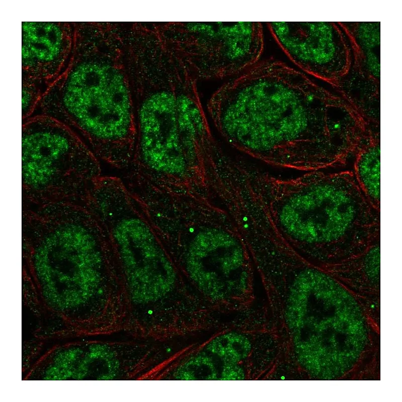 Atlas Antibodies Anti-NFKBIZ Antibody
