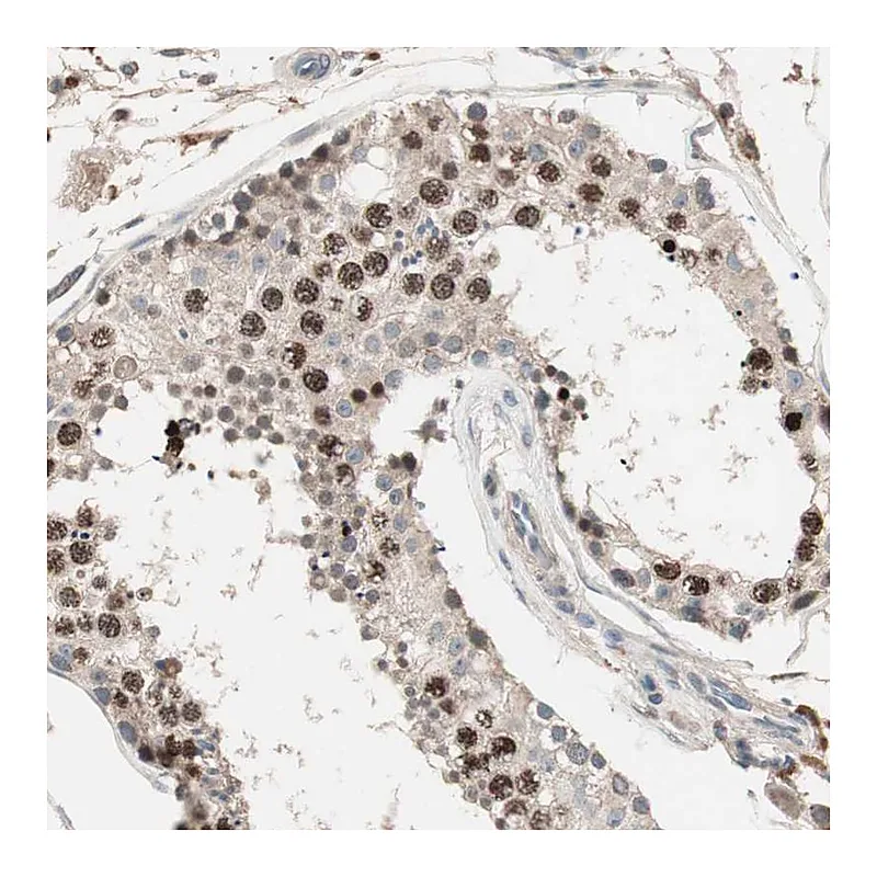 Atlas Antibodies Anti-NFRKB Antibody