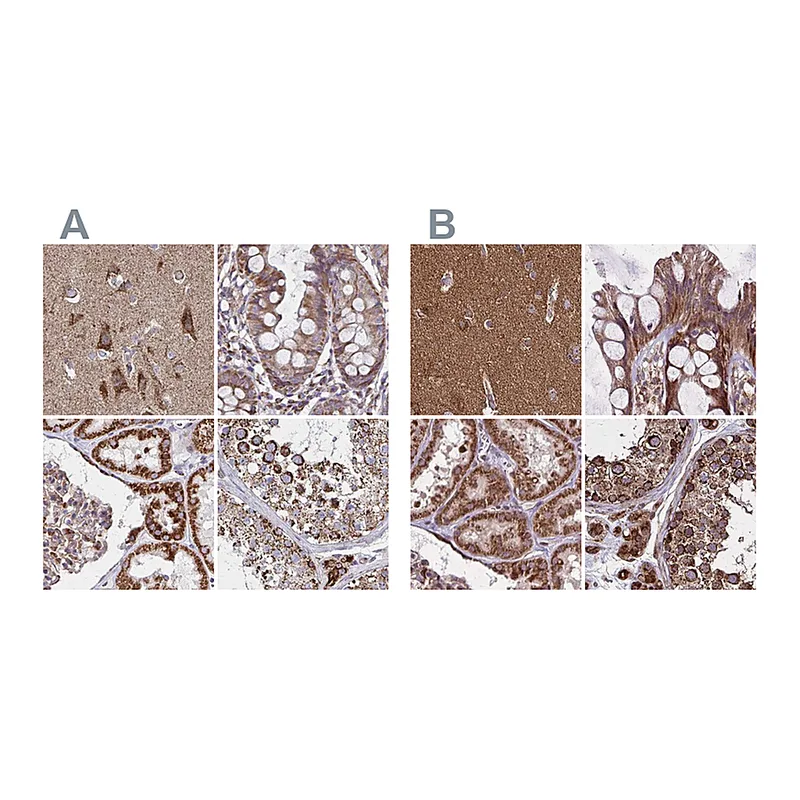 Atlas Antibodies Anti-NFS1 Antibody