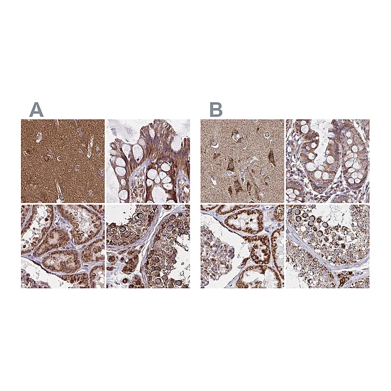 Atlas Antibodies Anti-NFS1 Antibody