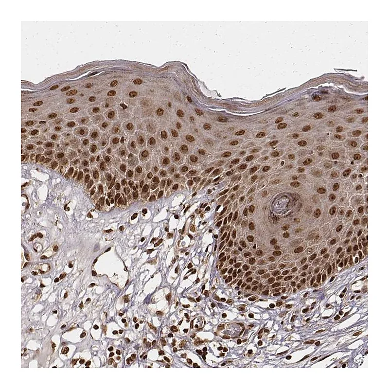 Atlas Antibodies Anti-NFX1 Antibody