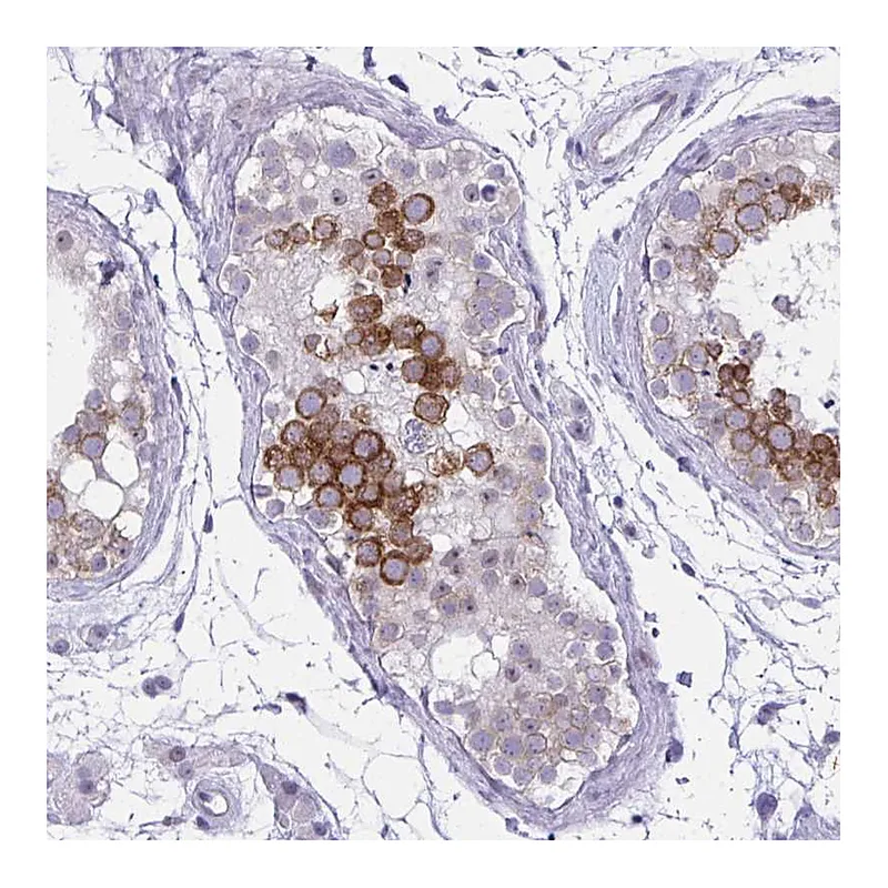 Atlas Antibodies Anti-NFXL1 Antibody