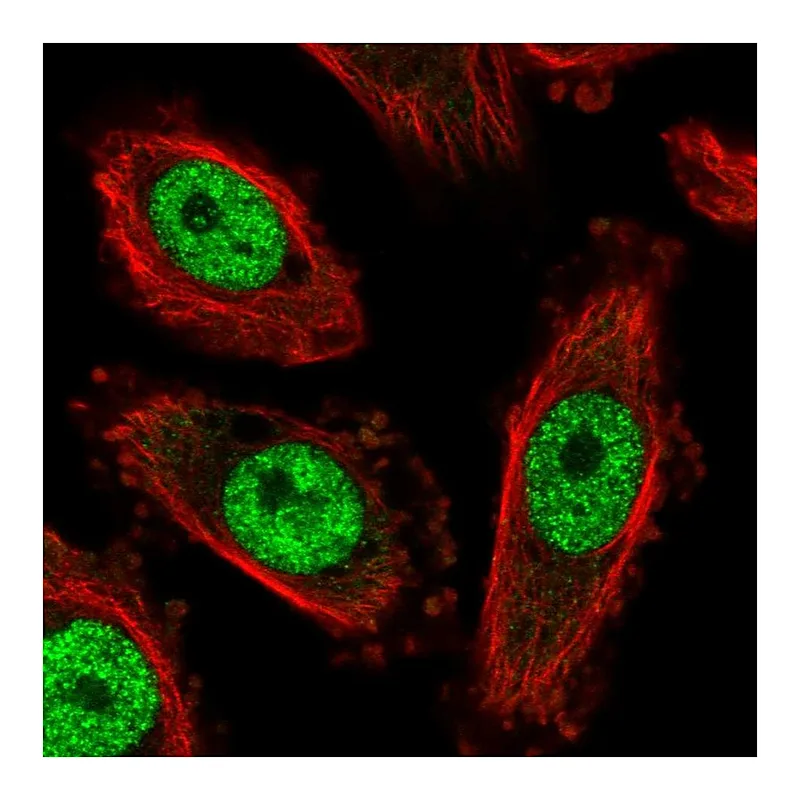 Atlas Antibodies Anti-NFYC Antibody