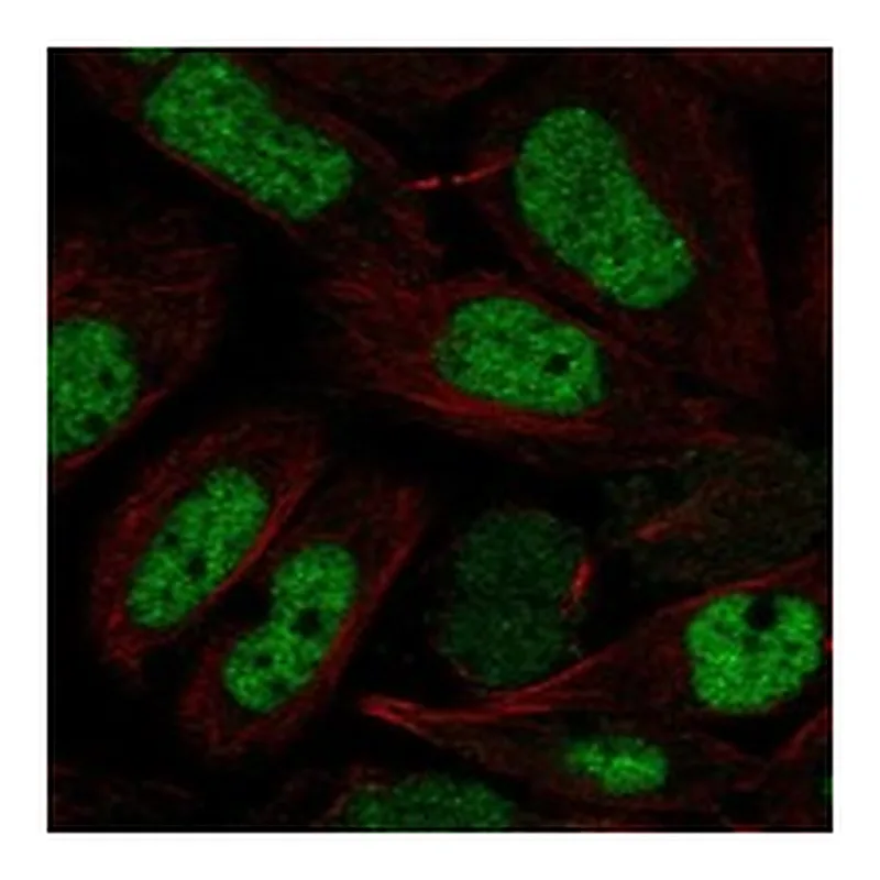 Atlas Antibodies Anti-NFYB Antibody