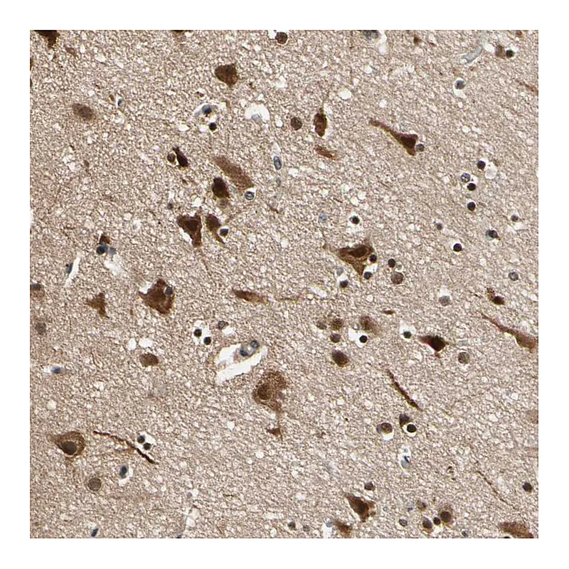 Atlas Antibodies Anti-NGEF Antibody