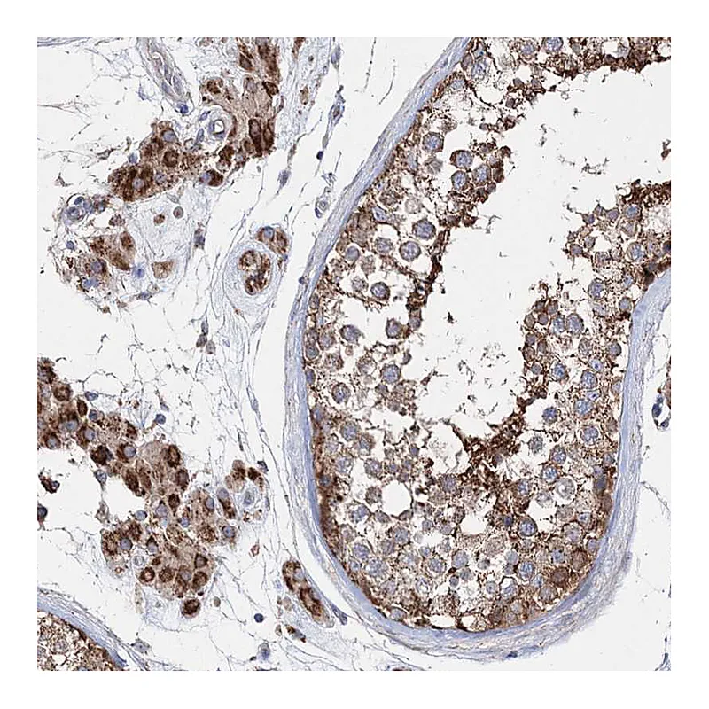 Atlas Antibodies Anti-NGLY1 Antibody
