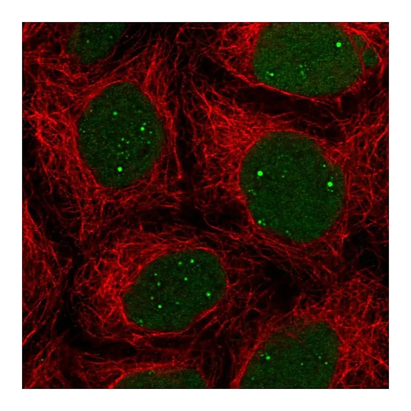 Atlas Antibodies Anti-NHEJ1 Antibody