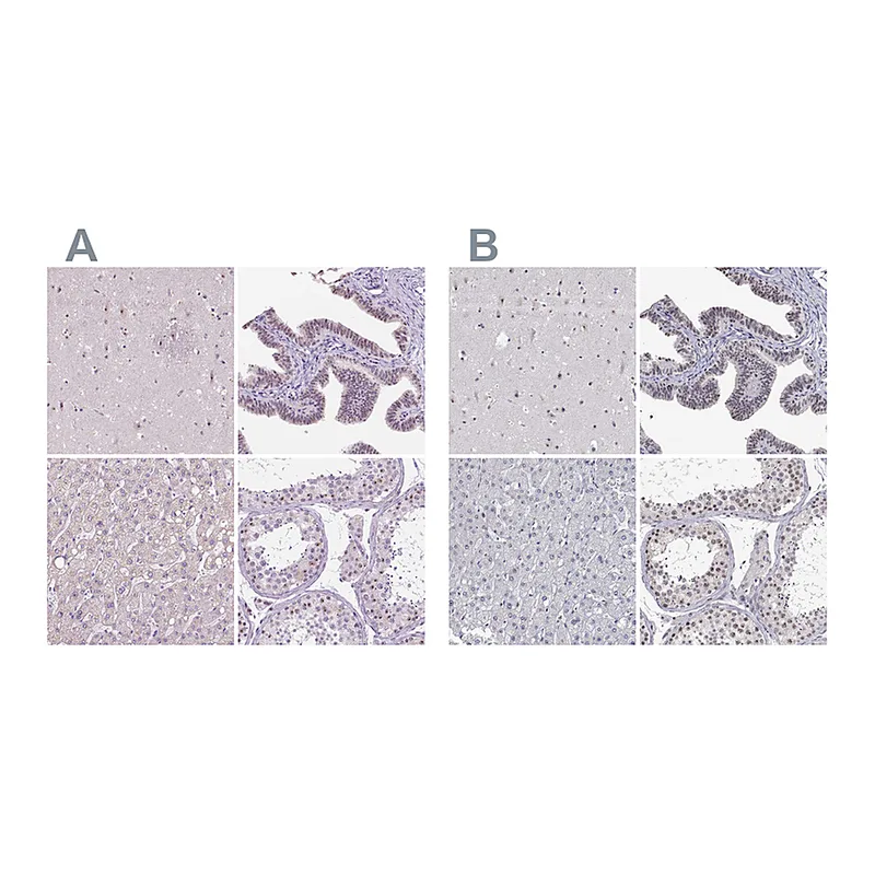 Atlas Antibodies Anti-NHP2 Antibody