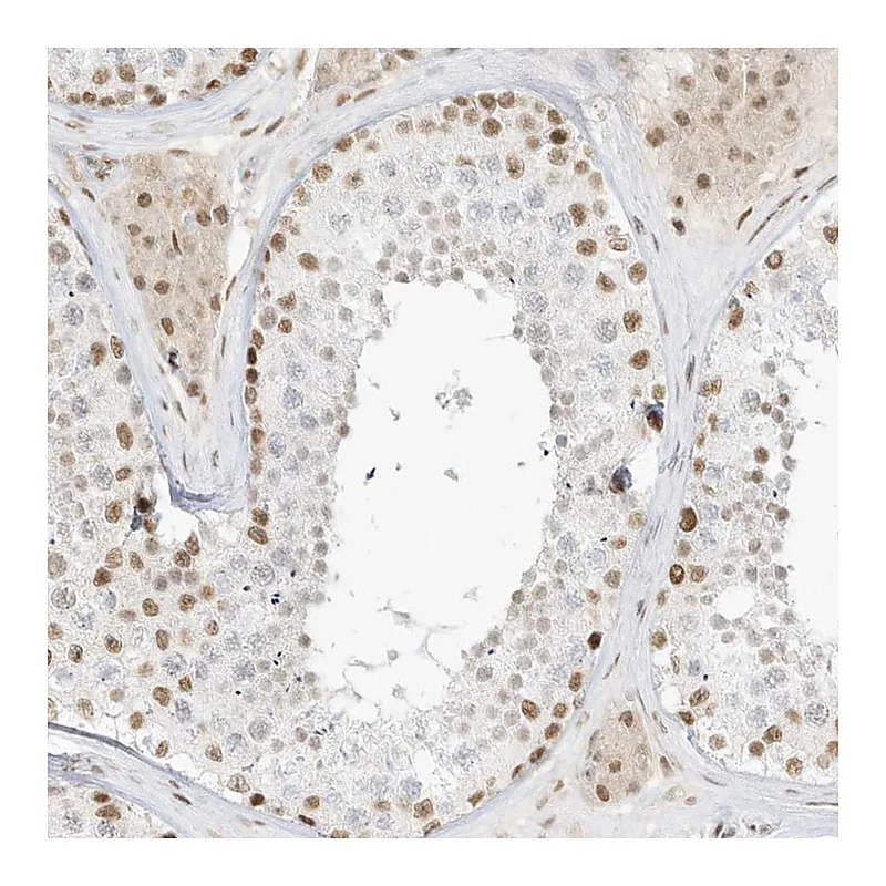Atlas Antibodies Anti-NHSL1 Antibody