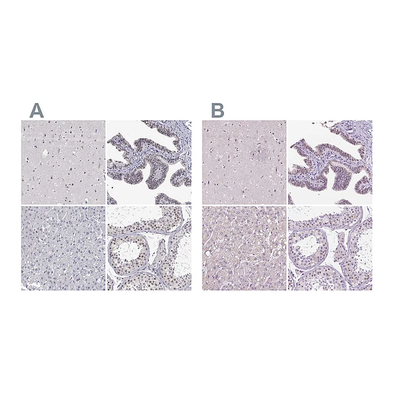 Atlas Antibodies Anti-NHP2 Antibody