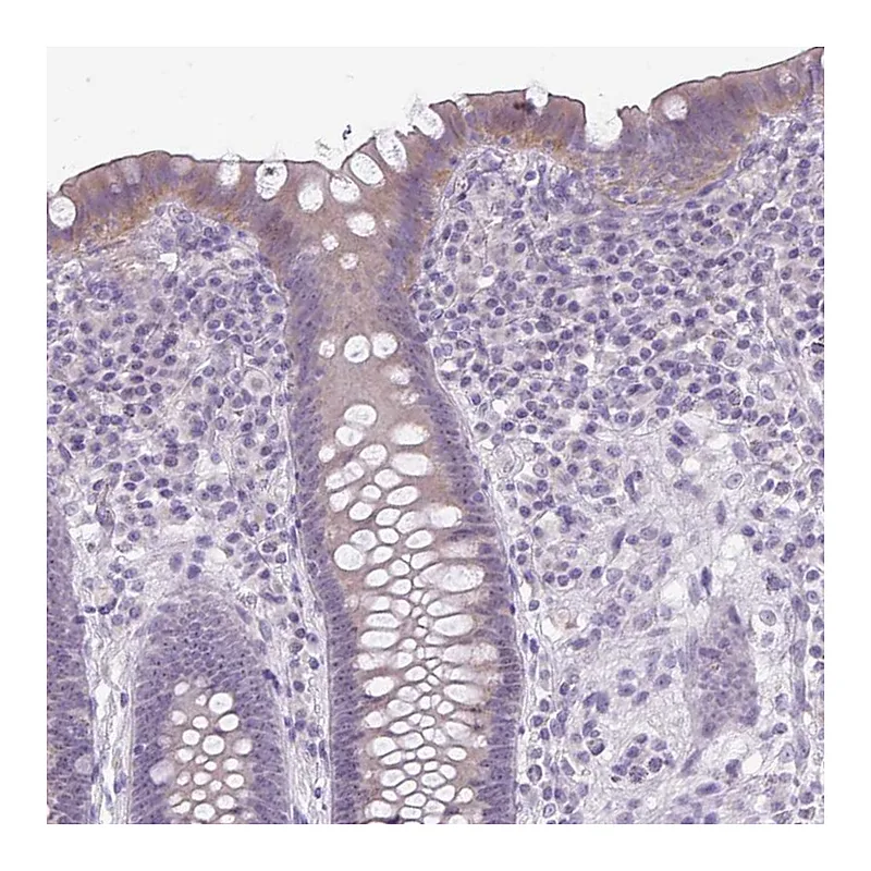 Atlas Antibodies Anti-NHSL2 Antibody