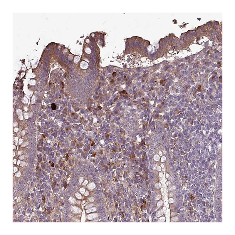 Atlas Antibodies Anti-NHSL2 Antibody