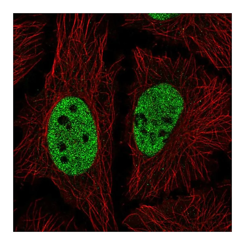 Atlas Antibodies Anti-NICN1 Antibody