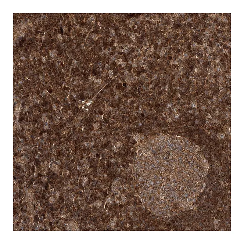 Atlas Antibodies Anti-NIF3L1 Antibody