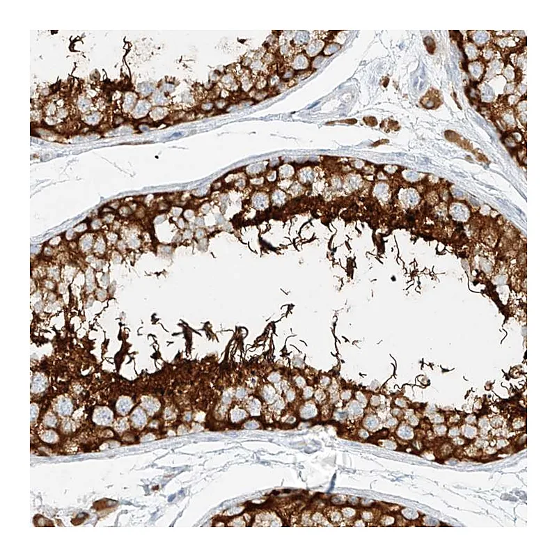 Atlas Antibodies Anti-NHSL1 Antibody