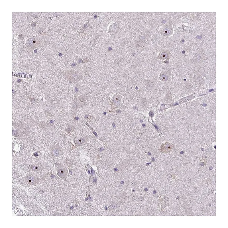 Atlas Antibodies Anti-NIFK Antibody
