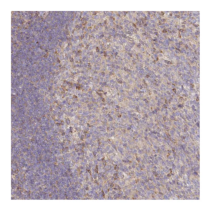 Atlas Antibodies Anti-NIN Antibody