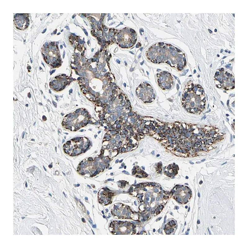 Atlas Antibodies Anti-NIM1K Antibody
