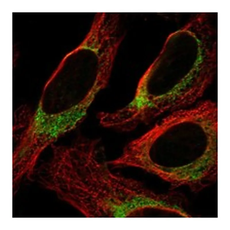 Atlas Antibodies Anti-NINJ2 Antibody