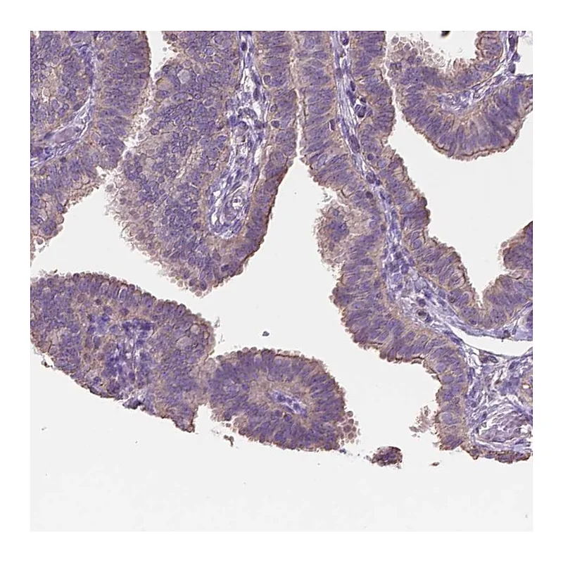 Atlas Antibodies Anti-NIPA2 Antibody
