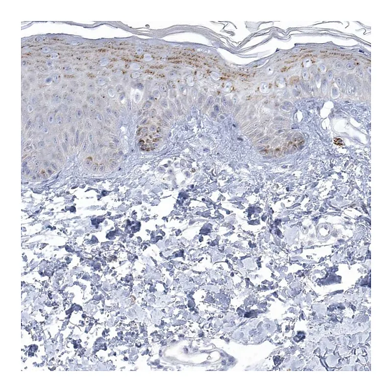 Atlas Antibodies Anti-NIPAL1 Antibody