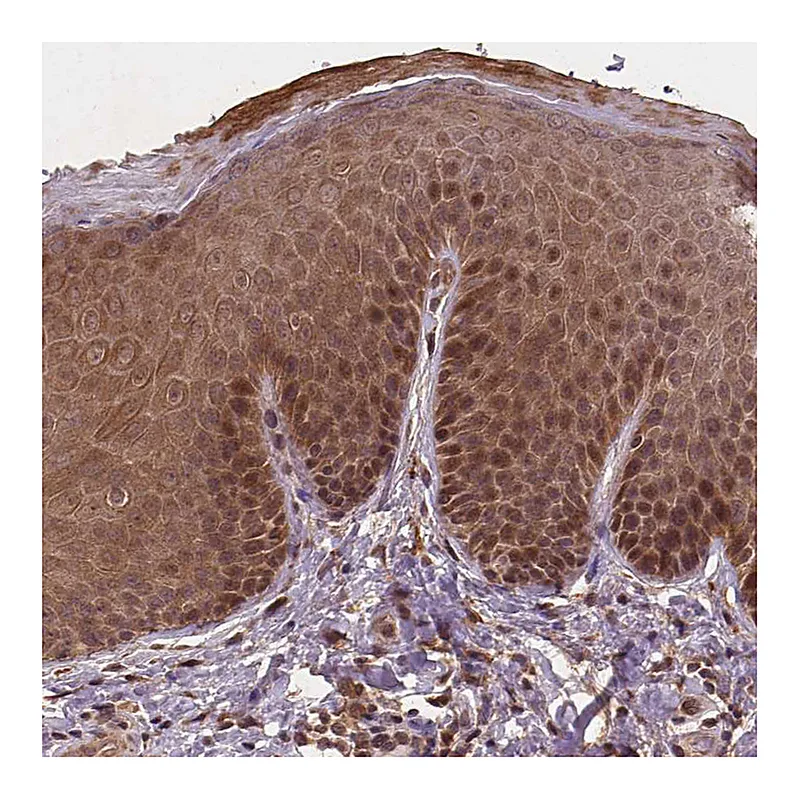 Atlas Antibodies Anti-NIPAL2 Antibody
