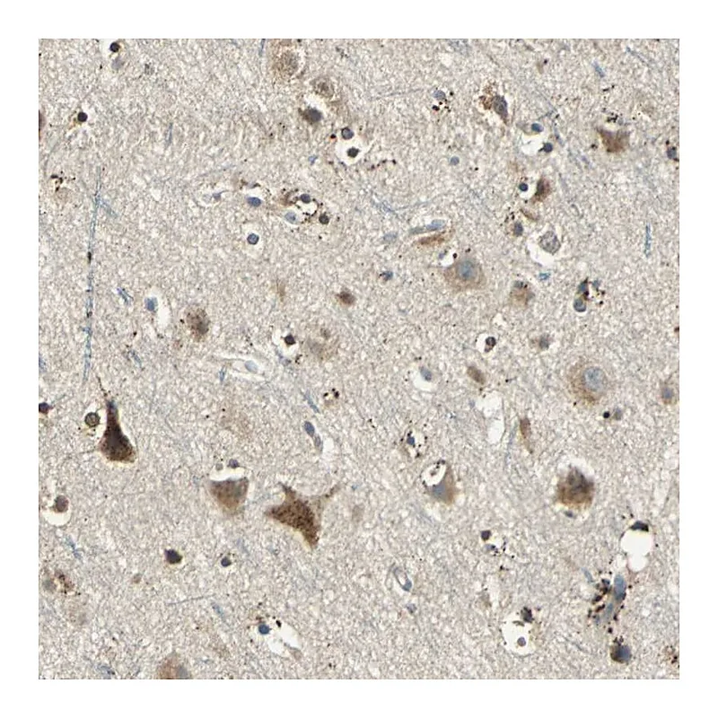 Atlas Antibodies Anti-NIT1 Antibody